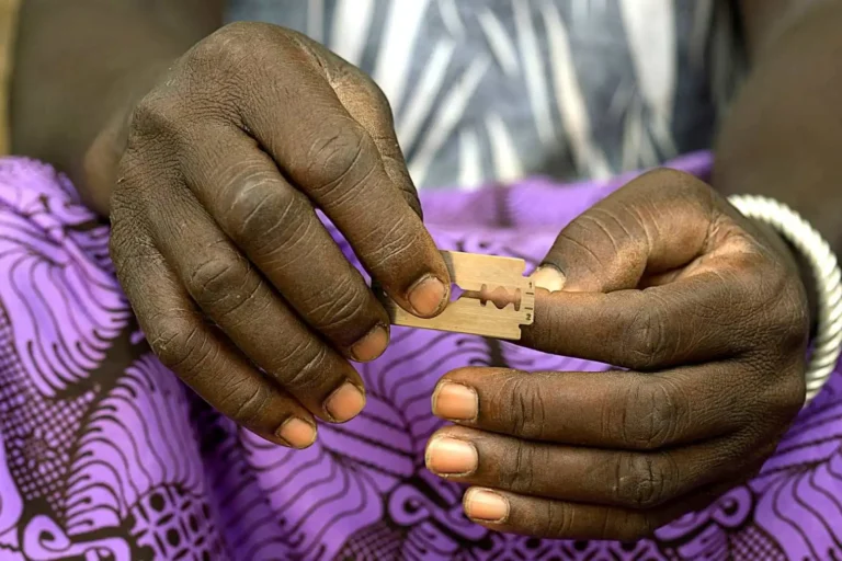 S’inaugura una exposició sobre la mutilació genital femenina
