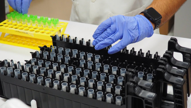 Mostres de PCR