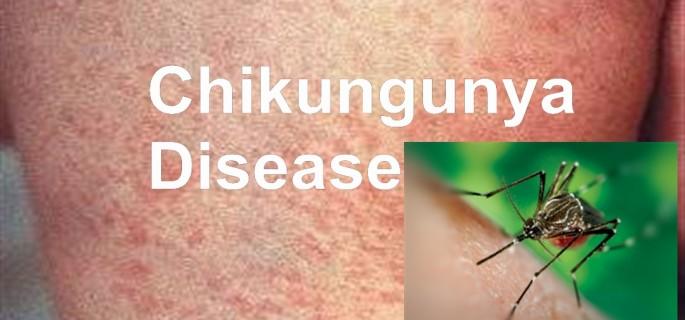 Salut detecta a Lloret una infecció del virus Chikungunya