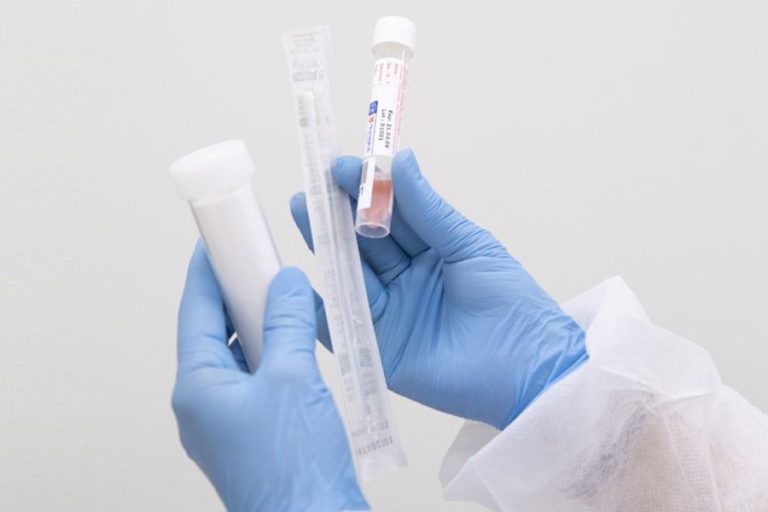 test pcr coronavirus
