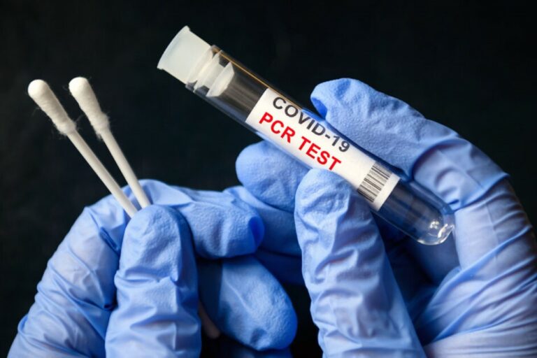 Un test PCR per detectar la Covid-19 (Segurilatam)